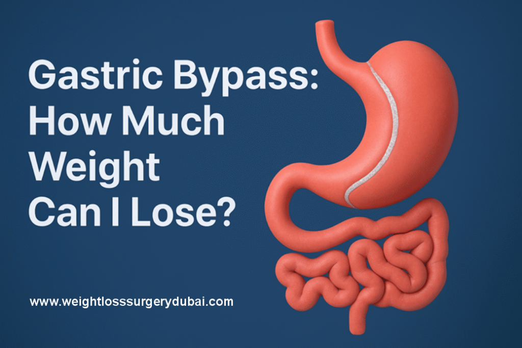Gastric Bypass: How Much Weight Can I Lose?
