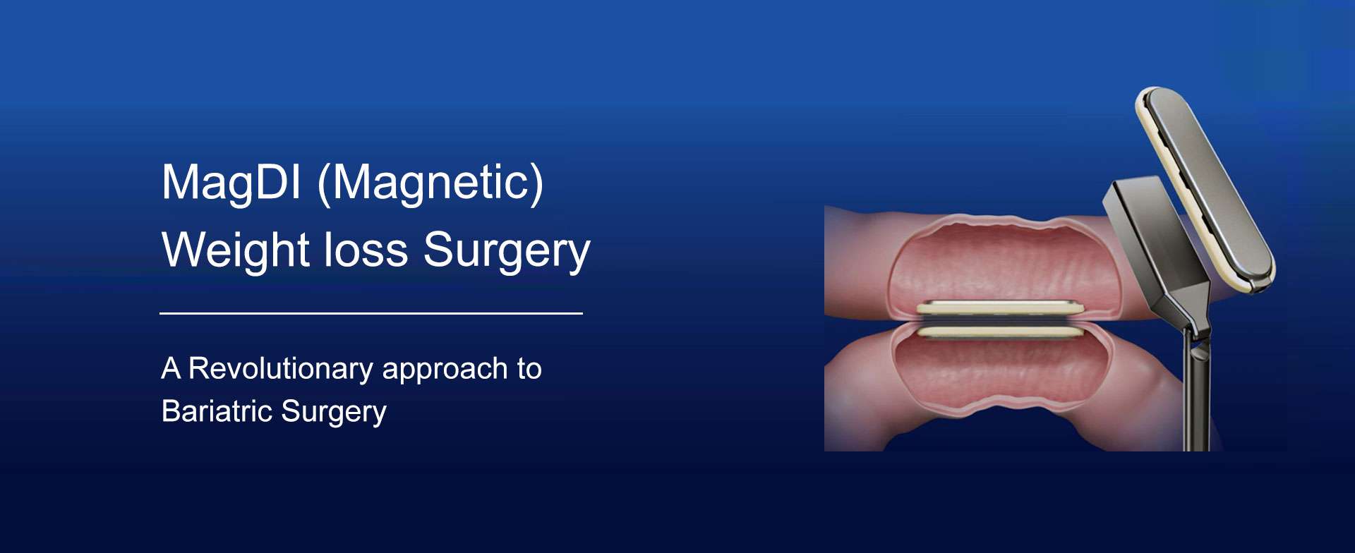 MagDI-Magnetic-Weight-loss-Surger_Dubai