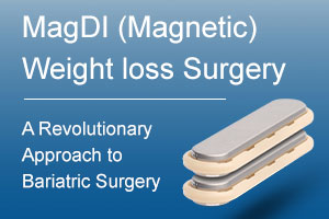 MagDI-Magnetic-Weight-loss-Surgery