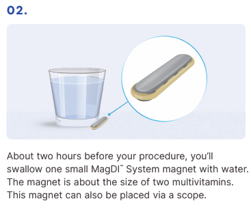 MagDI System - How it works 02