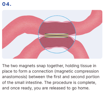MagDI System - How it works 04