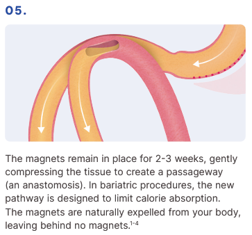 MagDI System - How it works 05