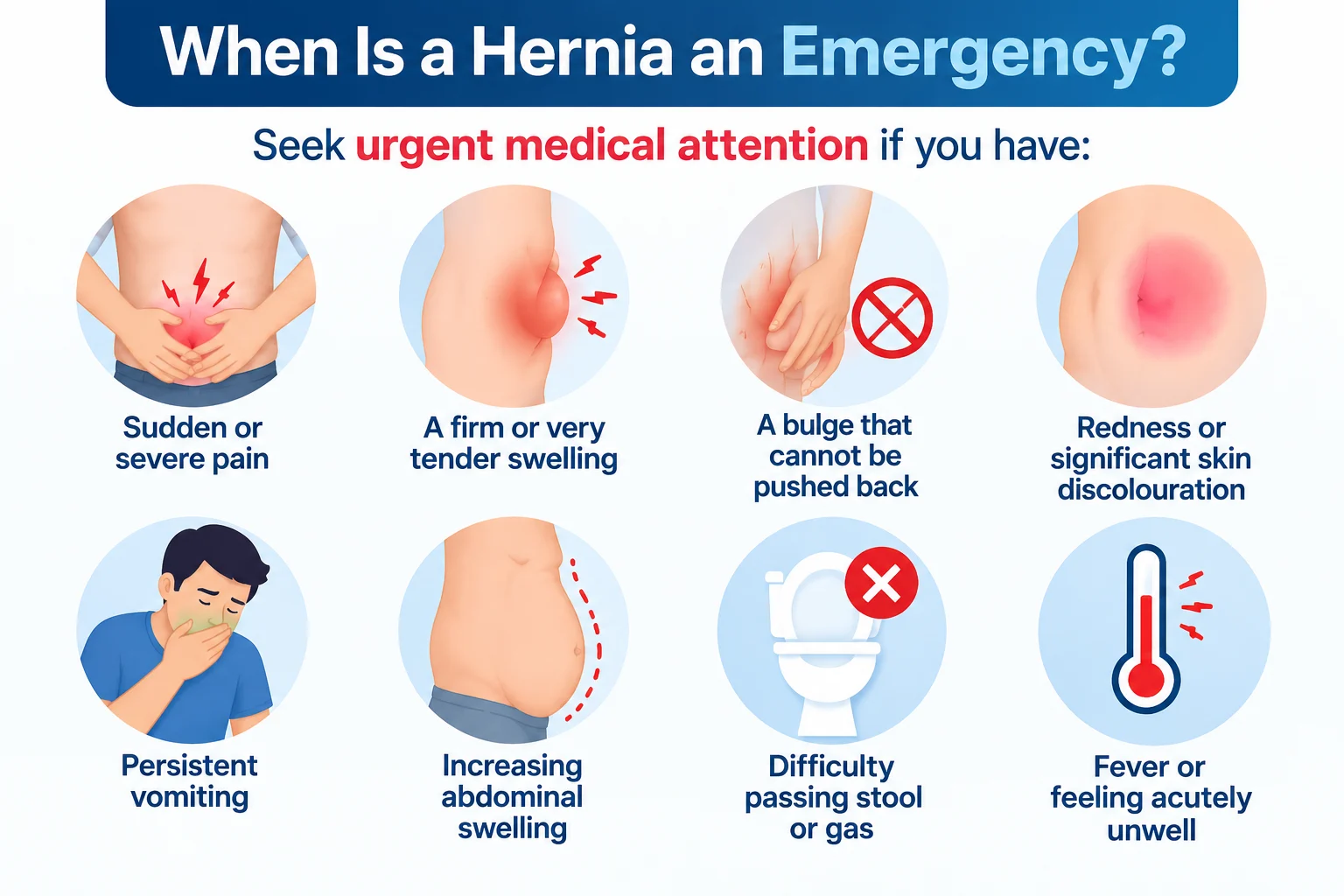 Medical infographic showing warning signs of a hernia emergency, including severe pain, tender swelling, irreducible bulge, skin discoloration, vomiting, abdominal swelling, difficulty passing stool or gas, and fever