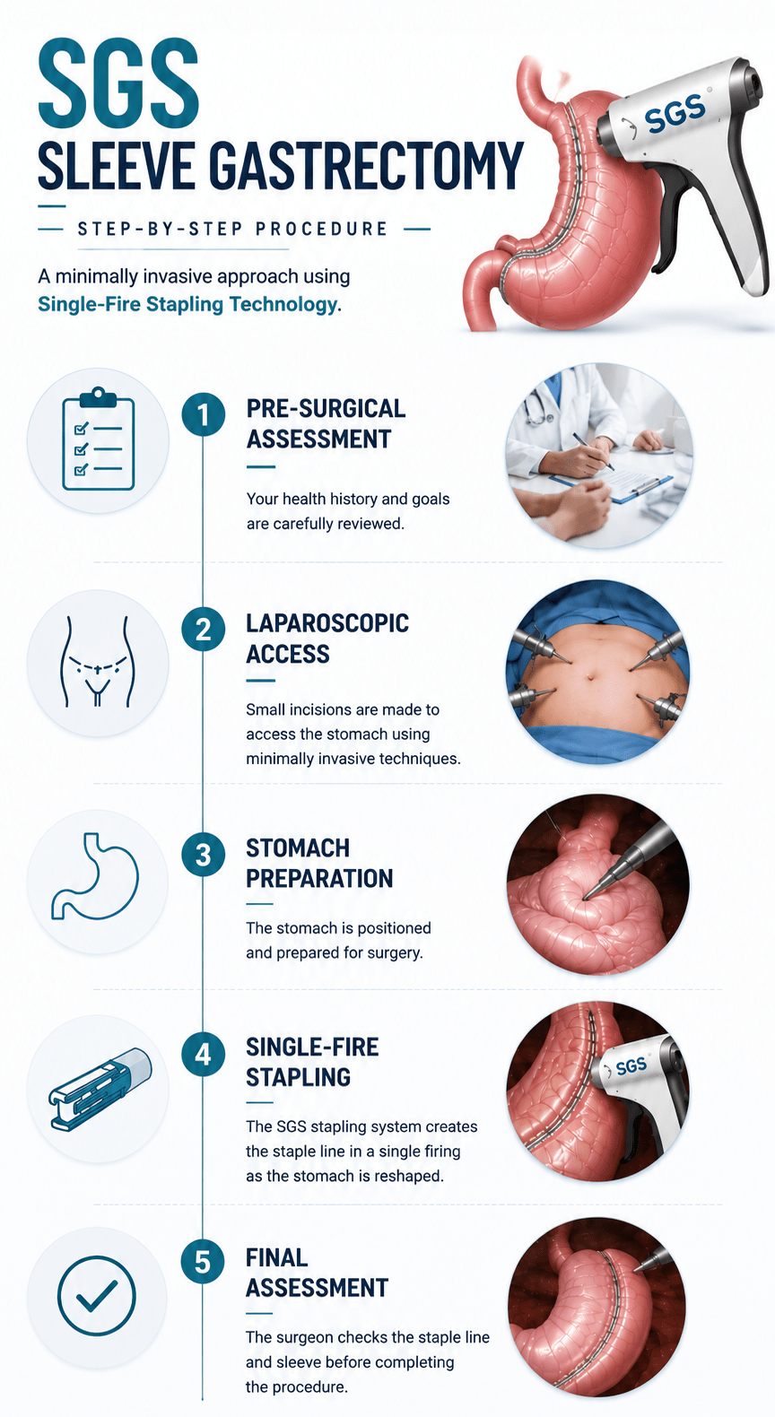 sgs sleeve gastrectomy step by step procedure