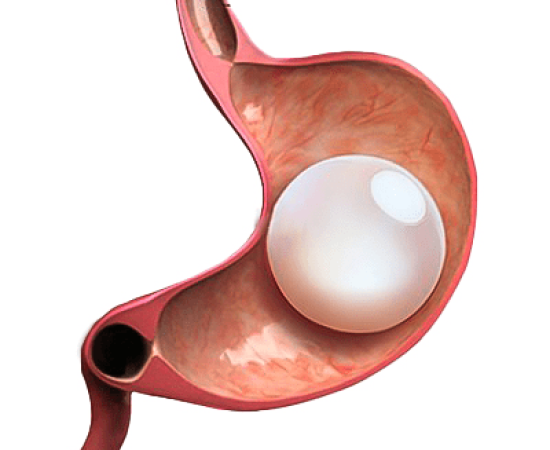 Orbera Balloon in Dubai