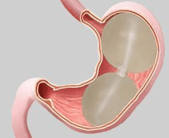 Reshape Balloon in Dubai