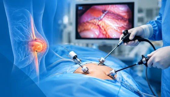 Laparoscopic hernia surgery with minimally invasive surgical instruments in Dubai